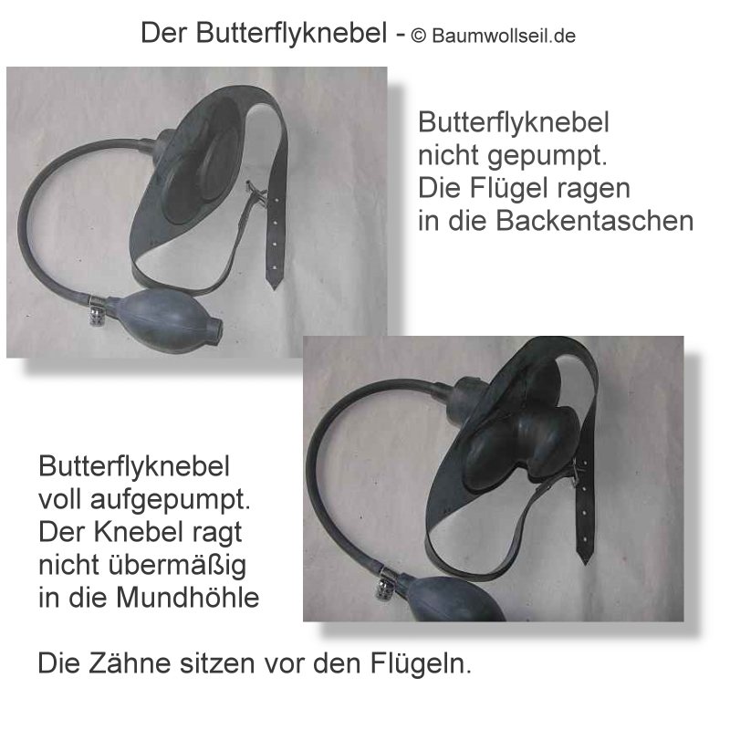 Abbildungen Butterfly-Knebel